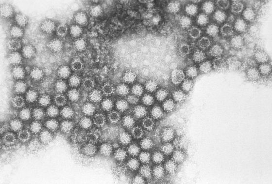 FELINE CALICIVIRUS (FCV)