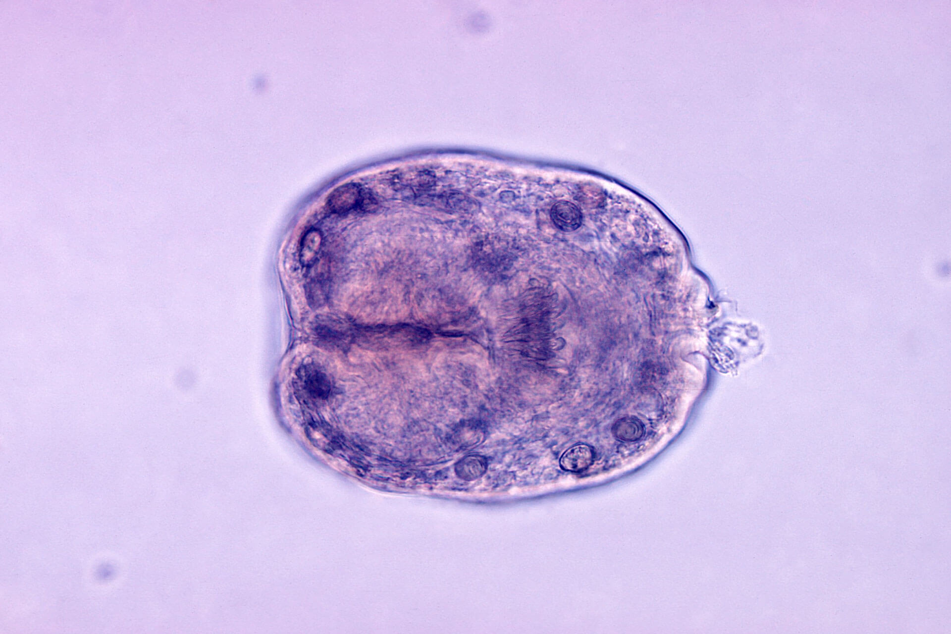 ECHINOCOCCUS GRANULOSUS ( CAT / DOG CYST DISEASE )